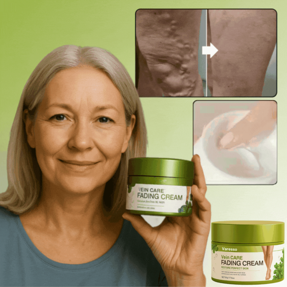 Varesso™ Varicose Vein Cream | avlägsnar 96% av åderbråcken på 3 dagar