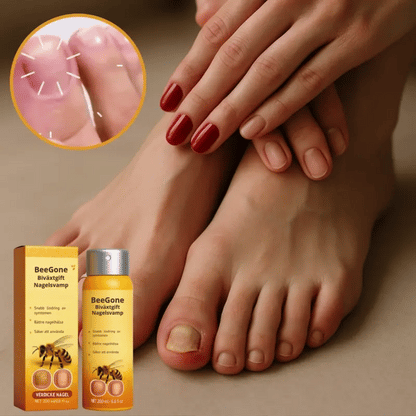 BeeGone™ Cream | Eliminerar 98% av nagelsvamp på 5 dagar